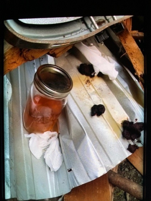 Photo of human excrementband jar filled with urine